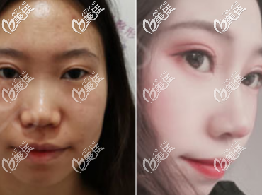 20200629_1593423776515026.png blob.png