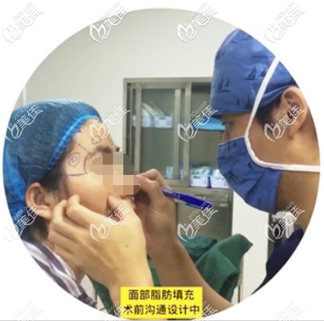 術(shù)前設(shè)計(jì)面部脂肪填充部位 術(shù)前設(shè)計(jì)面部脂肪填充部位