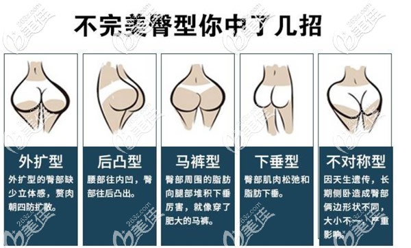 不好看的臀型有哪些