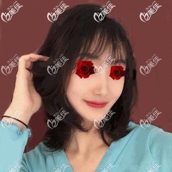 玻尿酸豐下巴術(shù)后7天照