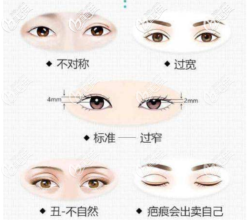 需要修復(fù)的雙眼皮類型 需要修復(fù)的雙眼皮類型