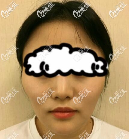 顴骨高下頜骨寬大臉型的樣子