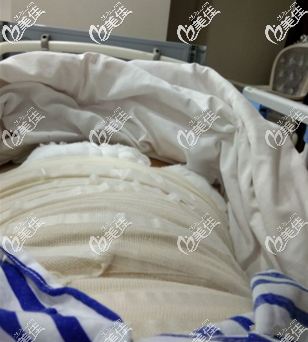 第二天還在病床上