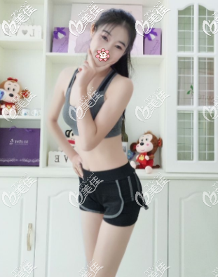 腰腹抽脂抽了2000cc多不多能瘦幾厘米？下面是我在泰國TARA CLINIC醫(yī)院的經(jīng)歷