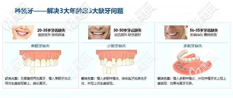 種植牙優(yōu)勢(shì)介紹圖