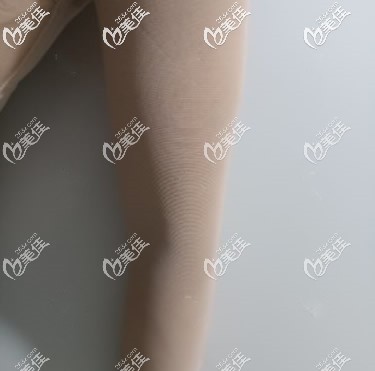 蘭州時(shí)光逯巖給我做手臂環(huán)吸第1天 蘭州時(shí)光逯巖給我做手臂環(huán)吸第1天