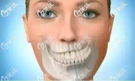 牙齒偏頜通過牙套能矯正嘛 牙齒偏頜通過牙套能矯正嘛