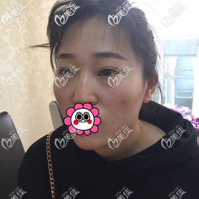 這是做手術(shù)前的我 這是做手術(shù)前的我