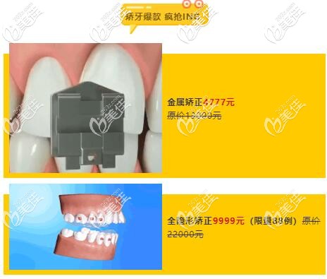有人說正雅隱形牙套15000價格便宜,沒想到武漢德韓口腔7月驚爆價9999更劃算