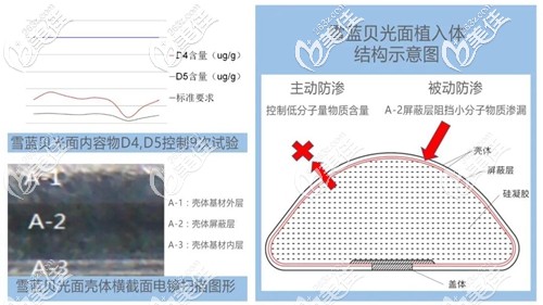 雪藍貝隆胸假體隆胸的效果優(yōu)勢