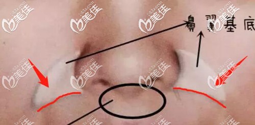 紅線就是小胡子的位置