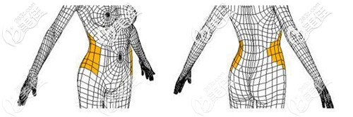 腰腹吸脂的位置