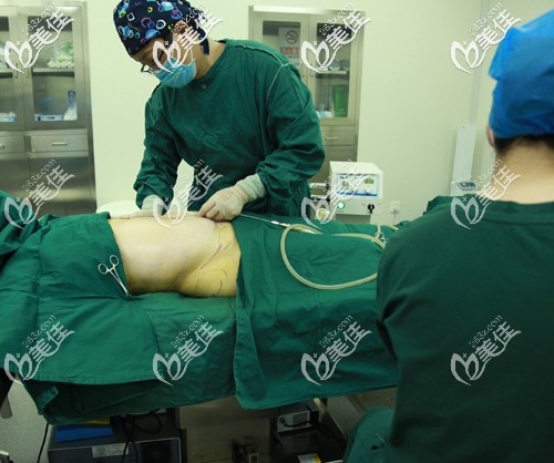 腰腹環(huán)吸真實(shí)圖片