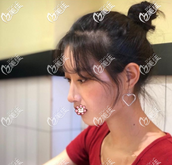 我對(duì)這個(gè)鼻子特別滿意 我對(duì)這個(gè)鼻子特別滿意