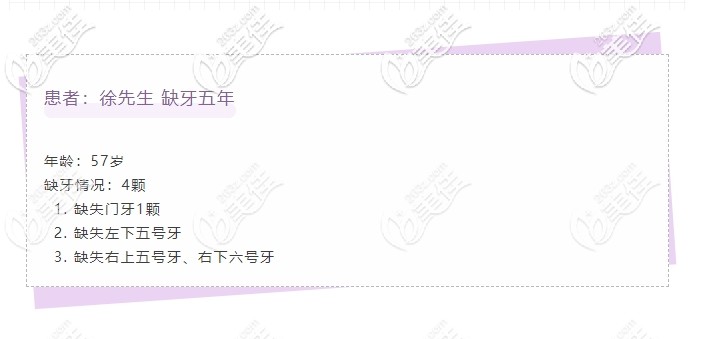 徐叔牙齒缺失病例 徐叔牙齒缺失病例