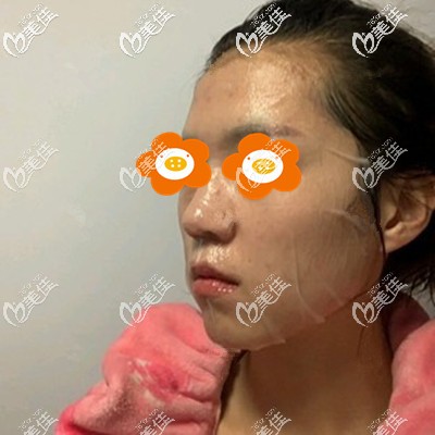 術(shù)后第3天敷著面膜