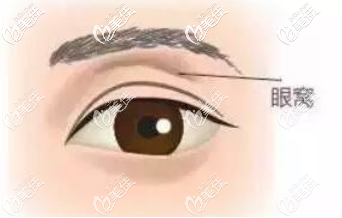 凹陷的眼窩示意圖