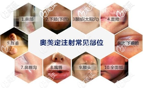 肖征剛奧美定取出技口碑評價