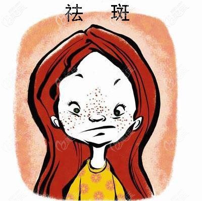 激光祛斑效果怎么樣