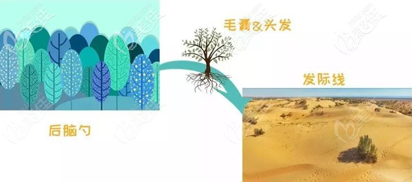 植發(fā)手術(shù)和植樹類似