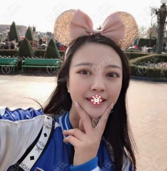 全臉脂肪填充一年后臉凹陷后悔死了你該看看我在重慶光博士的15天恢復照片