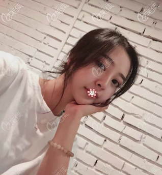 重慶光博士做脂肪填充怎么樣 重慶光博士做脂肪填充怎么樣