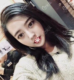 現(xiàn)在是好看的鵝蛋臉 現(xiàn)在是好看的鵝蛋臉