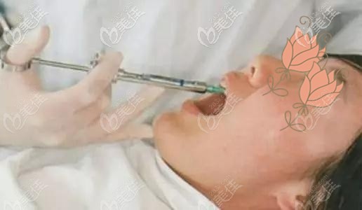 種植牙打麻藥示意圖 種植牙打麻藥示意圖