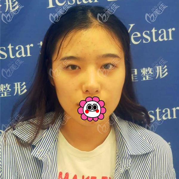 單眼皮眼睛無神 單眼皮眼睛無神