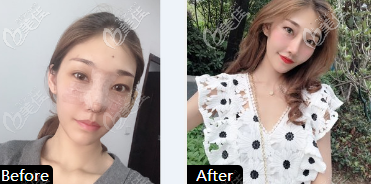 淄博美聯(lián)臣隆鼻<span style= 淄博美聯(lián)臣隆鼻<span style=