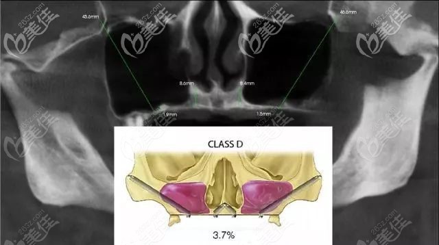 舉例：顧客術(shù)前口腔的評(píng)估結(jié)果