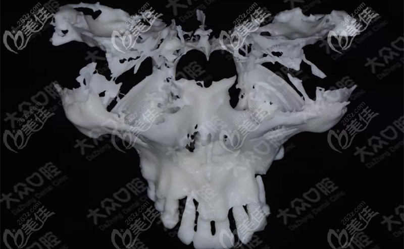顧客上頜骨的模型 顧客上頜骨的模型