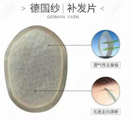 德國(guó)紗補(bǔ)發(fā)片示意圖 德國(guó)紗補(bǔ)發(fā)片示意圖