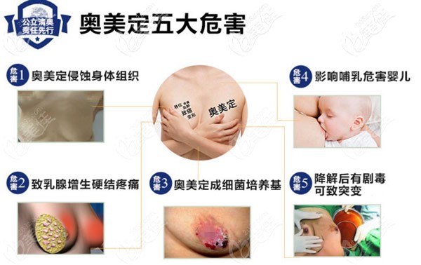 奧美定隆胸的危害