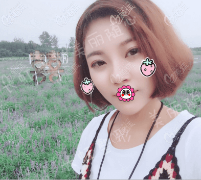 徐學(xué)東做鼻子如何？我在北京畫美找他做鼻綜合隆鼻48天<span style=