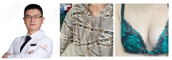 寧波薇琳做隆胸手術(shù)實(shí)例 寧波薇琳做隆胸手術(shù)實(shí)例