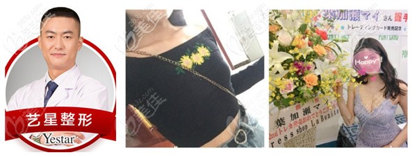 寧波藝星做隆胸手術(shù)實(shí)例 寧波藝星做隆胸手術(shù)實(shí)例