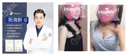 寧波靜港做隆胸實(shí)例 寧波靜港做隆胸實(shí)例