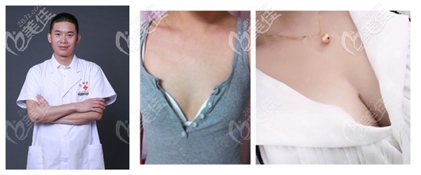 寧波江北尚麗醫(yī)療美容門(mén)診部隆胸實(shí)例 寧波江北尚麗醫(yī)療美容門(mén)診部隆胸實(shí)例