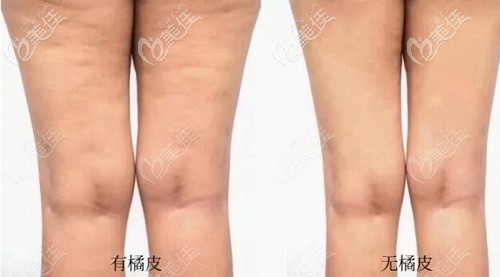 有無橘皮的對比