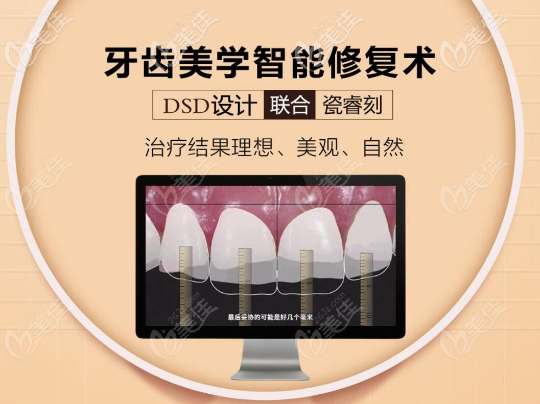 貴陽德韓數字化修復科王勝主任dsd美學修復