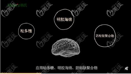 棉花糖豐胸的材質(zhì)