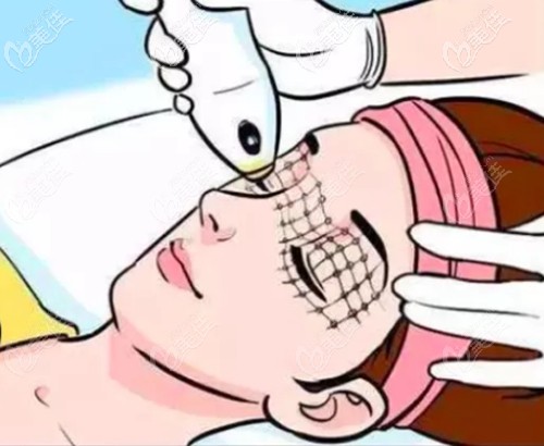 面部熱瑪吉治療部位