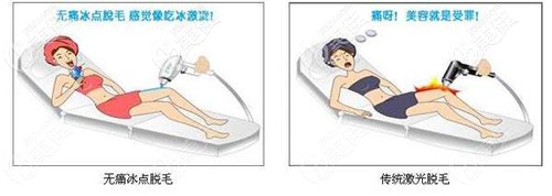 冰點(diǎn)脫毛和普通脫毛的區(qū)別