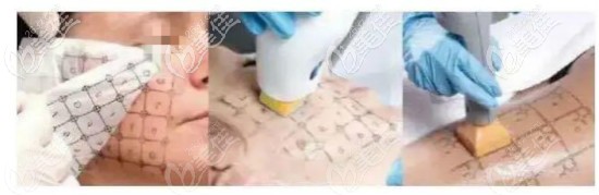 真熱瑪吉打法介紹 真熱瑪吉打法介紹