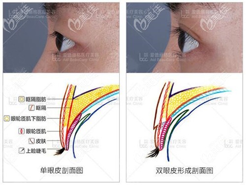 大連愛德麗格馮勇醫(yī)生雙眼皮優(yōu)勢 大連愛德麗格馮勇醫(yī)生雙眼皮優(yōu)勢