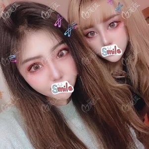 做眼鼻綜合術(shù)后一個月鼻子消腫 做眼鼻綜合術(shù)后一個月鼻子消腫