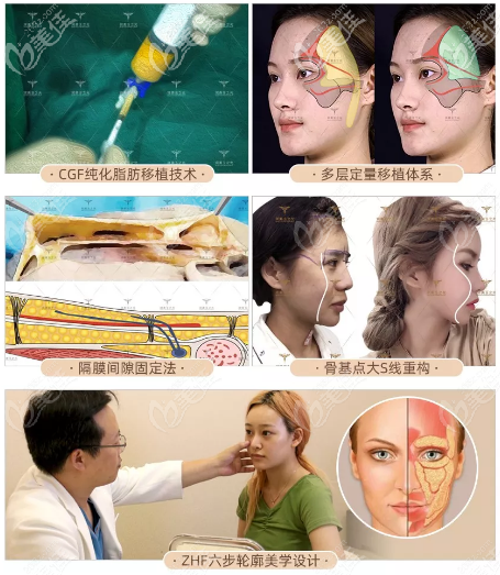北京玉之光張紅芳脂肪填充技術(shù) 北京玉之光張紅芳脂肪填充技術(shù)