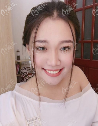 重慶華美打玻尿酸怎么樣