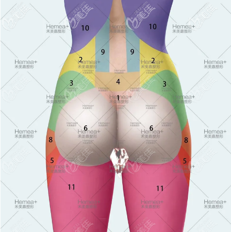 做個豐臀大概要多少錢 做個豐臀大概要多少錢